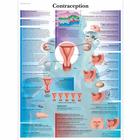 Lehrtafel - Contraception, 1001747 [VR2591L], Schwangerschaft und Geburt

