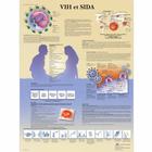   VIH et SIDA, 4006804 [VR2725UU], Parasitaires, virales ou Infection bactérienne