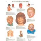 Lehrtafel - Les maladies infantiles, 1001780 [VR2741L], Parasit&auml;re, virale oder bakterielle Infektion (Small)