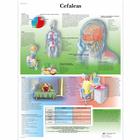 Lehrtafel - Cefaleas, 1001933 [VR3714L], Gehirn und Nervensystem