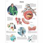 Lehrtafel - Asma, 1002019 [VR4328L], Atmungssystem
