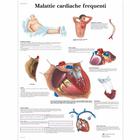 Malattie cardiache frequenti, 1002027 [VR4343L], Éducation Santé du Coeur et Fitness