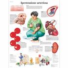 Ipertensione arteriosa, 1002033 [VR4361L], sistema Cardiovascolare