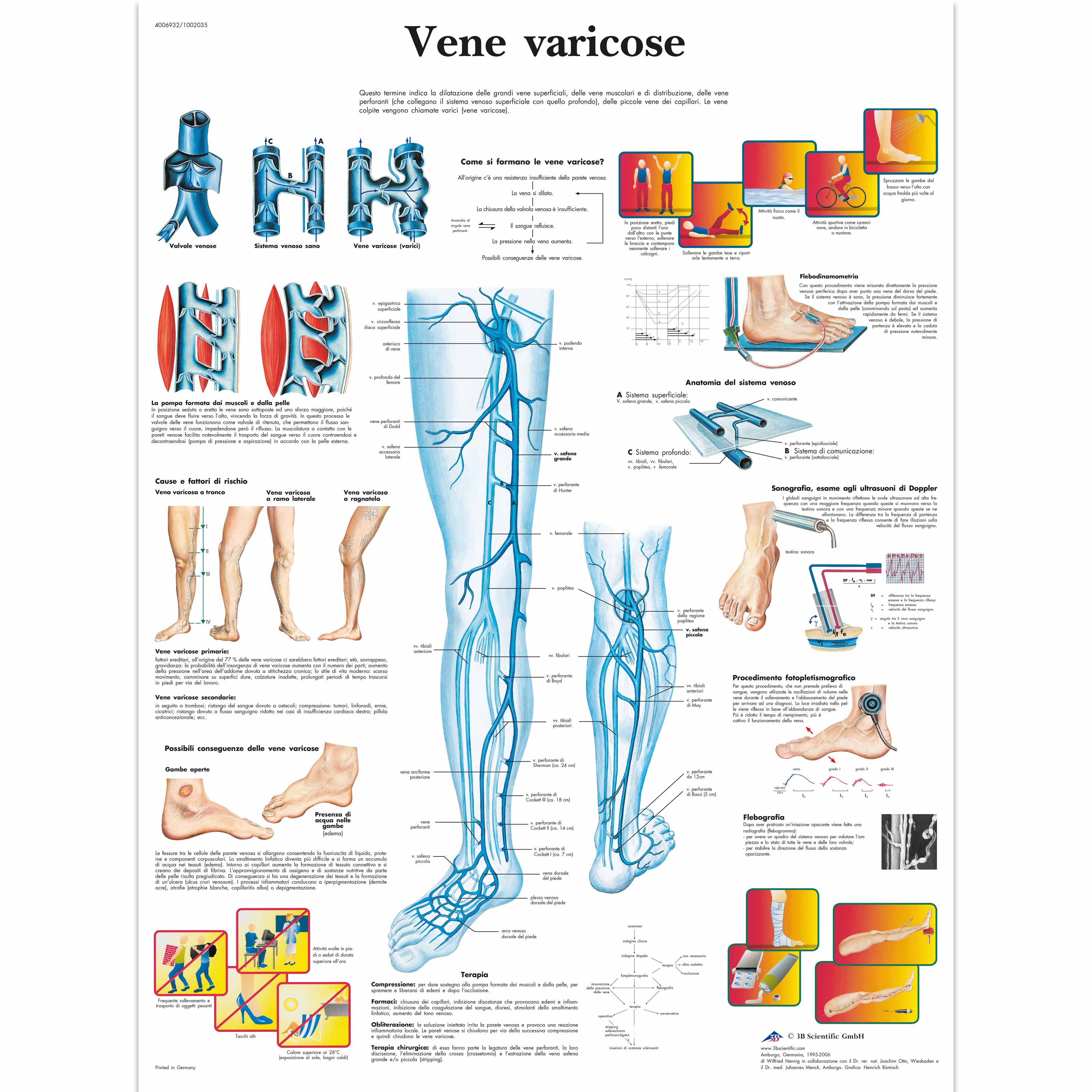 apizartron i vene varicoase