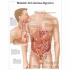 Malattie del sistema digestívo, 1002049 [VR4431L], El sistema digestivo