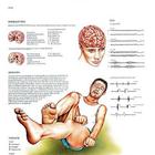 Lehrtafel - Epilessia, 4006960 [VR4626UU], Gehirn und Nervensystem