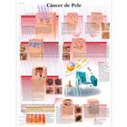 Cancer de Pele, 50x67 cm, Laminado, 1002155 [VR5295L], Cânceres
