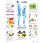 Медицинский плакат "Остеопороз", 1002215 [VR6121L], Плакаты по опорно-двигательному аппарату человека