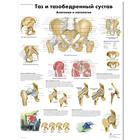 Медицинский плакат "Таз и тазобедренный сустав, анатомия и патология", 1002228 [VR6172L], Плакаты по опорно-двигательному аппарату человека