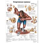 Медицинский плакат "Спортивные травмы", 1002236 [VR6188L], Плакаты по мышечной системе