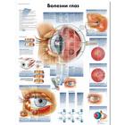Медицинский плакат "Болезни глаз", 1002239 [VR6231L], Плакаты по глазам (офтальмология)