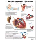 Медицинский плакат "Распространенные сердечные заболевания", 1002268 [VR6343L], Плакаты по кардиоваскулярной системе