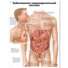 Медицинский плакат "Заболевания пищеварительной системы", 1002290 [VR6431L], Плакаты по пищеварительной системе
