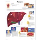 Медицинский плакат "Гепатит", 1002294 [VR6435L], Плакаты по метаболической системе