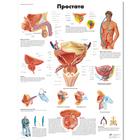 Медицинский плакат "Простата", 1002307 [VR6528L], Плакаты по мочеполовой системе
