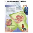 Female Urinary Incontinence Chart, 1002311 [VR6542L], Gynaecology