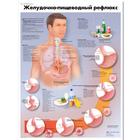 Медицинский плакат "Желудочно-пищевой рефлюкс", 1002343 [VR6711L], Плакаты по пищеварительной системе