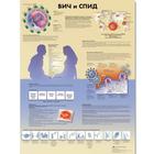 Медицинский плакат "ВИЧ и СПИД", 1002351 [VR6725L], Плакаты по паразитам, вирусам, бактериям