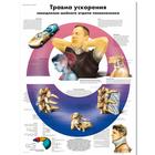 Медицинский плакат "Травма ускорения шейного отдела позвоночника", 1002355 [VR6761L], Плакаты по опорно-двигательному аппарату человека