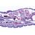 Vermes (Helminthes) - Espagnol, 1003858 [W13003S], Préparations microscopiques LIEDER (Small)