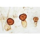 Pilze und Flechten (Fungi, Lichenes), Almanca (20'li), 1003892 [W13013], Mikroskop Kaydırıcılar LIEDER