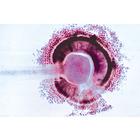 Champignons et lichens - Allemand, 1003892 [W13013], Lames microscopiques Allemand (Small)