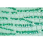 Bryophyta (Liverworts and Mosses) - German Slides, 1003896 [W13014], 현미경 슬라이드 LIEDER
