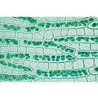 Bryophyta (Liverworts and Mosses) - Spanish, 1003899 [W13014S], Microscope Slides LIEDER