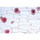 Angiospermes, cellules et tissus - Fran&ccedil;ais, 1003909 [W13017F], Lames microscopiques Fran&ccedil;ais (Small)