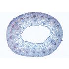 Angiospermes, tiges - Portugais, 1003918 [W13019P], Lames microscopiques Portugais (Small)