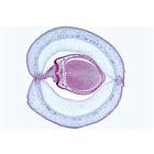 Angiospermes, fruits et graines - Fran&ccedil;ais, 1003929 [W13022F], Lames microscopiques Fran&ccedil;ais (Small)