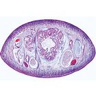 Vermes (Helminthes) - Anglais, 1003962 [W13032], Lames microscopiques Anglais (Small)
