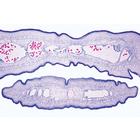Vermes (Helminthes) - Anglais, 1003962 [W13032], Lames microscopiques Anglais (Small)