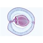 Angiospermae VII. Fruits and Seeds - English Slides, 1003980 [W13051], 영어 (Small)