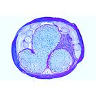 The Ascaris megalocephala Embryology - German, 1013478 [W13084], Lames de microscope