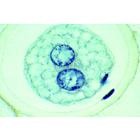 Эмбриология лошадиной аскариды (Ascaris megalocephala), на немецком языке, 1013478 [W13084], Типы деления клеток (Small)