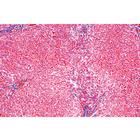 Pathologie humaine s&eacute;rie de base - Allemand, 1004094 [W13311], Lames microscopiques Allemand (Small)