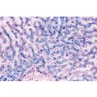 Human Pathology - German Slides, 1004094 [W13311], German (Small)