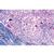 Pathologie humaine série de base - Allemand, 1004094 [W13311], Préparations microscopiques LIEDER (Small)