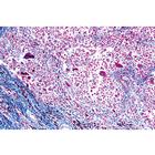 Human Pathology - French, 1004095 [W13311F], French (Small)