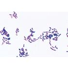 Pathogenic Bacteria - German Slides, 1004146 [W13324], 미세 입자