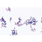 Bakterien als Krankheits- und Seuchenerreger - Spanisch, 1004149 [W13324S], Mikropräparate LIEDER
