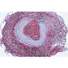 Arrangement and Types of Vascular Bundles - Portuguese Slides, 1004172 [W13330P], Portuguese (Small)