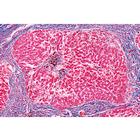 Pathologie humaine s&eacute;rie de base - Anglais, 1004236 [W13411], Lames microscopiques Anglais (Small)