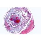 Genital System - English Slides, 1004241 [W13416], 영어 (Small)