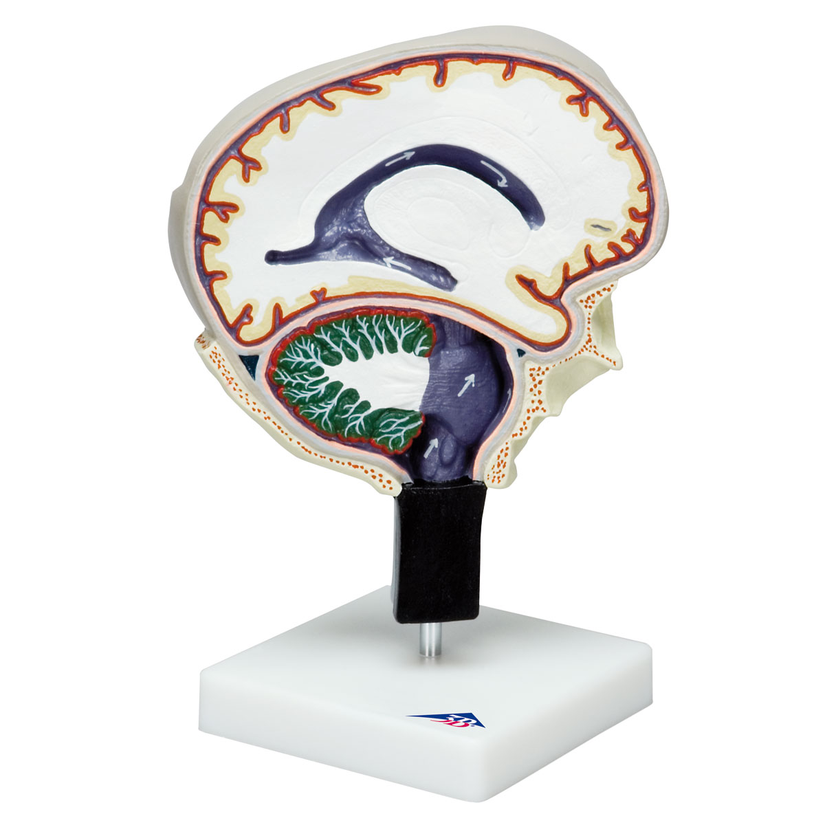 Сувенир мозг. Точная анатомическая модель мозга. Цереброспинальный комплайнс. Мозг в разрезе после инсульта. 5 см мозга