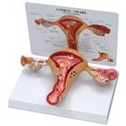 Gebärmutter-Eierstockmodell, 1019594 [W33352], Genital- und Beckenmodelle