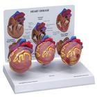 Conjunto de tres modelos de corazón tamaño reducido, 1019530 [W33365], Modelos de Corazón