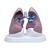 Conjunto de pulmón con patologías, 1018749 [W33371], Modelos de Sistema Respiratorio (Small)