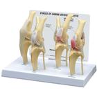 Modelo de rodilla con osteoartritis canina, normal + 3 patologías, 1019577 [W33373], Osteología